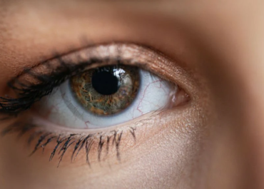 Colored Contacts for Astigmatism: Combining Corrective Power with Fashion